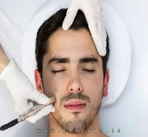 جوانسازی پوست در مردان به همراه روش های جوانسازی پوست صورت